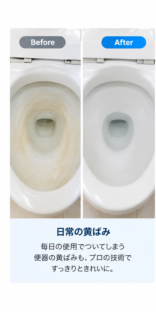 日常の黄ばみ